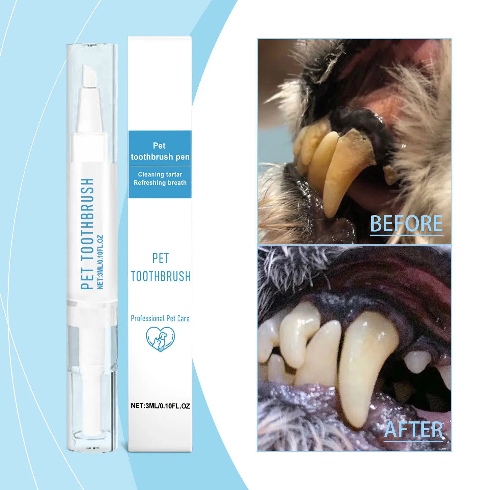 Pen Teeth Cleaning